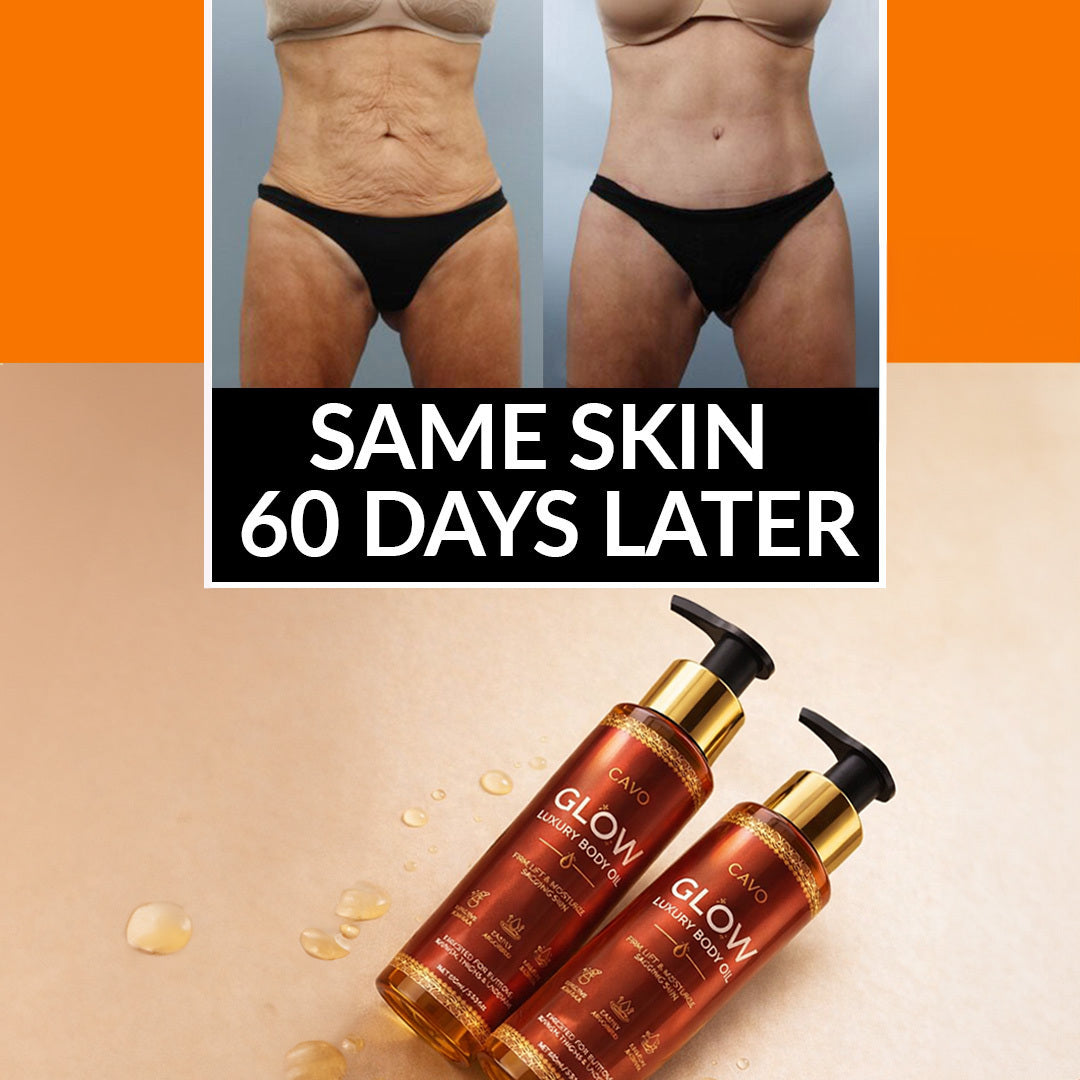 Same Skin 60 Days Later