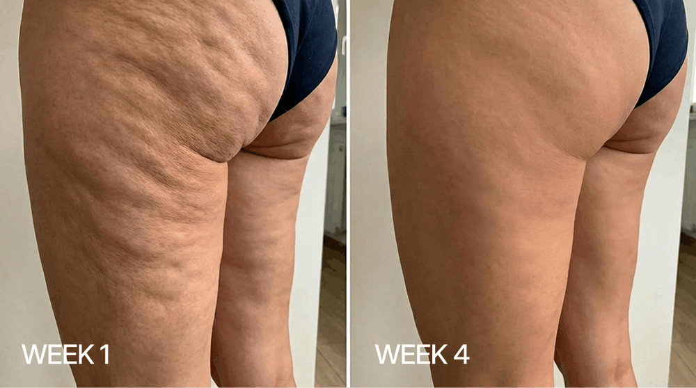 Week 1 and Week 4 skin comparison
